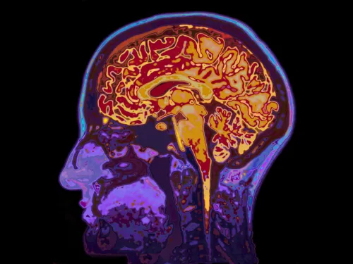 MRI cross-section of a human brain