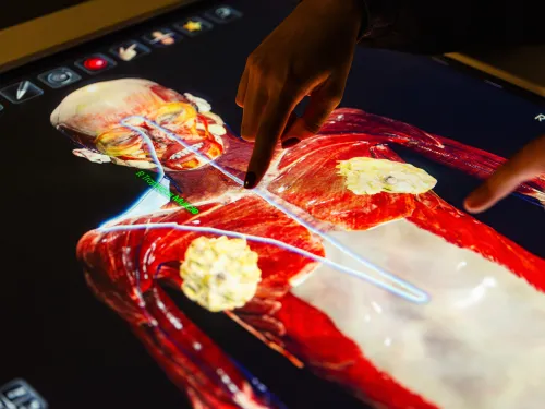 Digital Body Scan Anatomage Table 