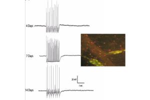 line traces of action potentials and a photo of a cell under fluorescent microscope