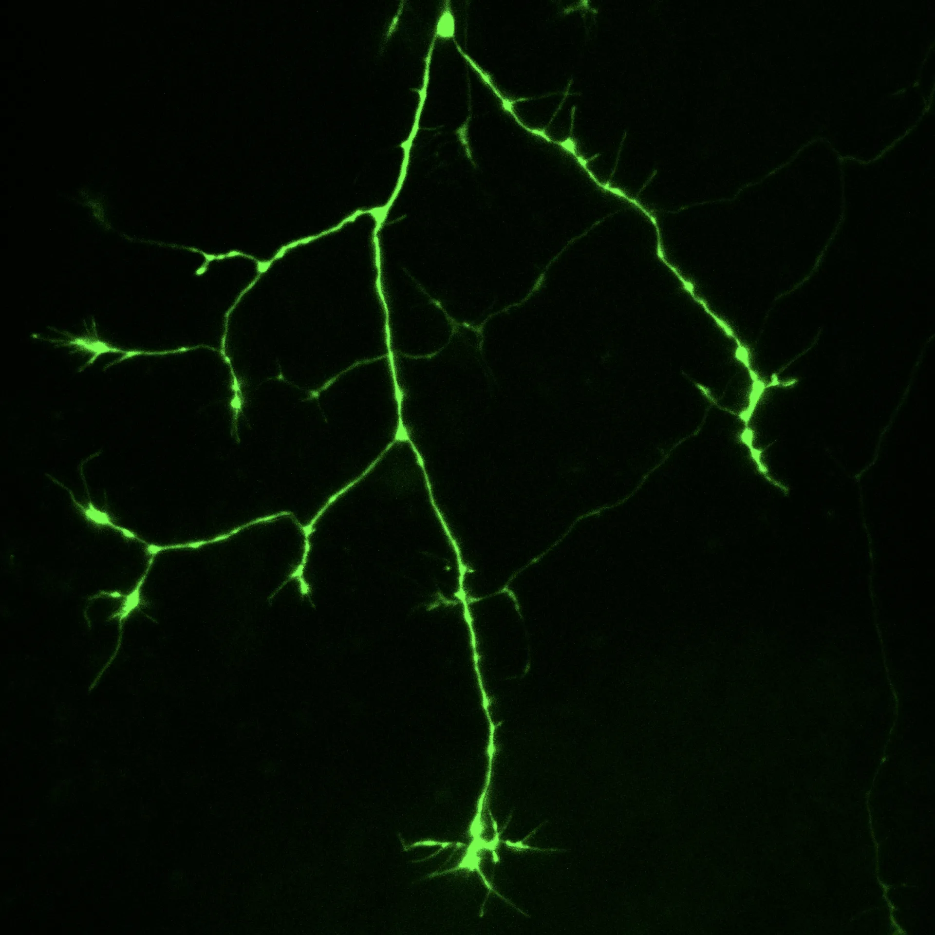 A growing sensory neuron of a living zebrafish embryo.